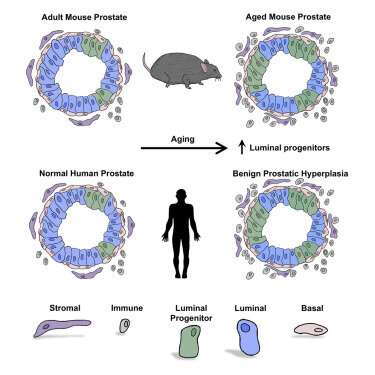 Study links progenitor cells to age-related prostate growth