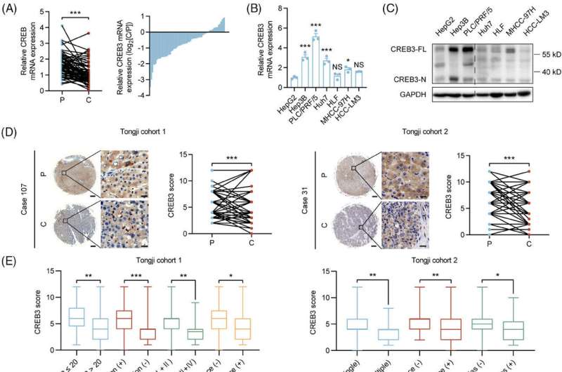 Study reveals CREB3's role in hepatocellular carcinoma suppression via AKT signaling