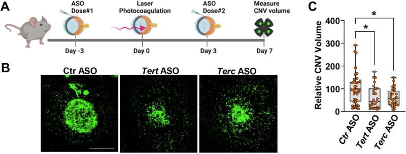 A new target for treatment of one type of macular degeneration