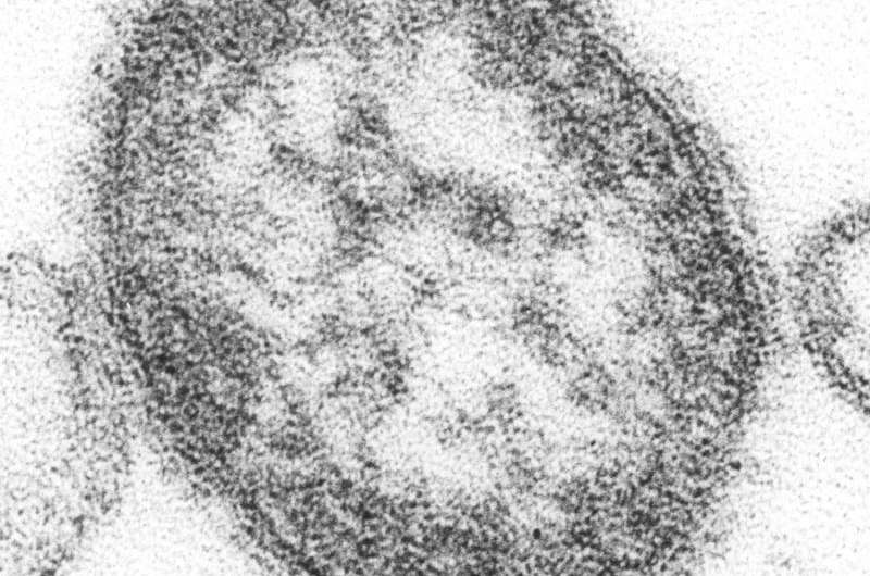 Health officials warn of potential measles exposure from 'international traveler' in Boston