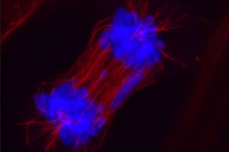 The role of RNF114B, a key gene in the progression and treatment of lung adenocarcinoma, has been discovered