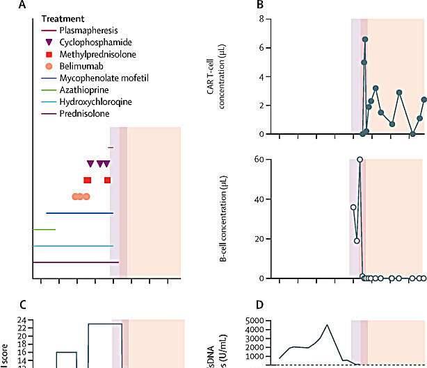 World's first CAR-T cell therapy for a child with lupus