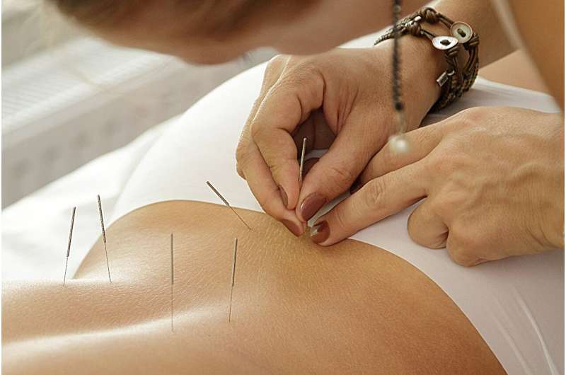 Acupuncture may relieve pain-specific disability in degenerative lumbar stenosis