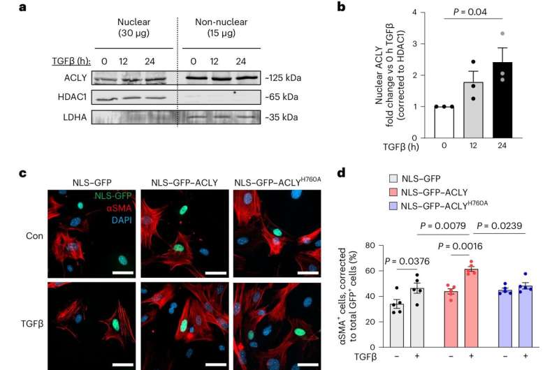 The mechanism behind cardiac fibrosis, opening way for new heart failure treatments