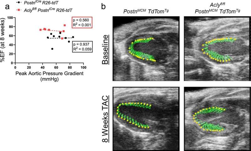 Study elucidates mechanism behind cardiac fibrosis, opening way for new heart failure treatments