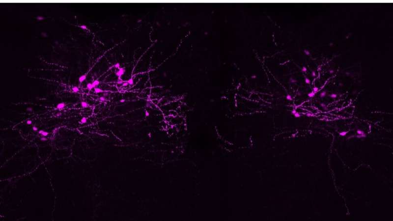 Monell Center discovery could help reduce adverse side effects of popular next-generation obesity medications