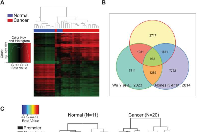 Study reveals gene 'switched off' in early stages of pancreatic cancer allows rapid tumor growth and spread