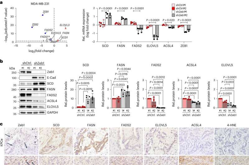 A treatment for metastasis? Using ferroptosis to attack migrating cancer cells