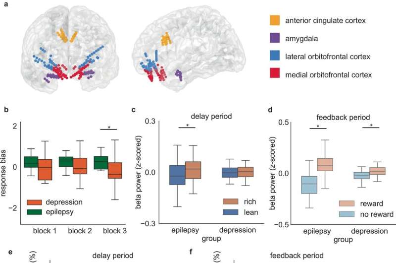 A novel and unique neural signature for depression revealed
