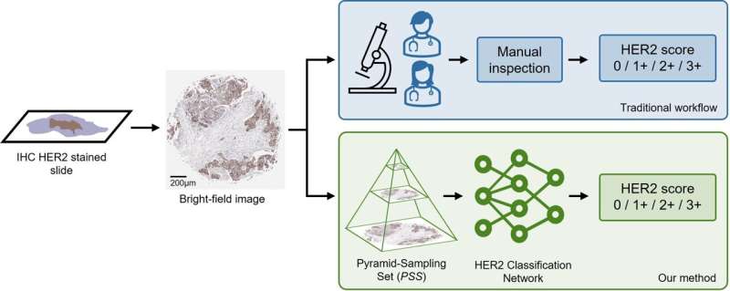 Deep learning approach enhances HER2 scoring in breast cancer