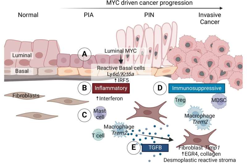 Oncoprotein activity increases prostate cancer progression