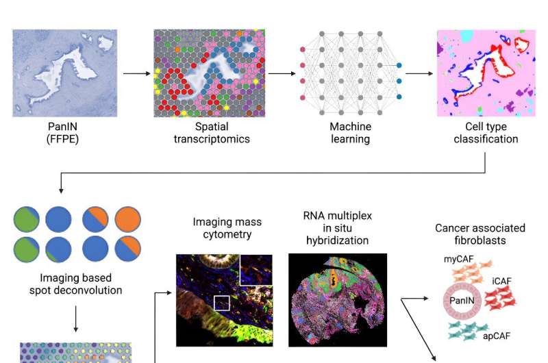 Identifying key markers in pancreatic cancer progression using a new analysis pipeline