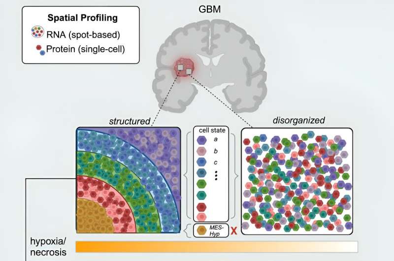 High-resolution brain tumor mapping reveals possible reason why some patients don't respond to new drug