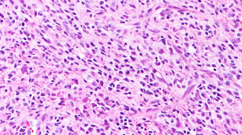 Potential new drug could target rare childhood brain tumor