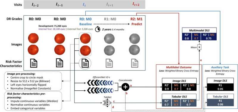 NHS data enables AI model for optimizing diabetic eye screening