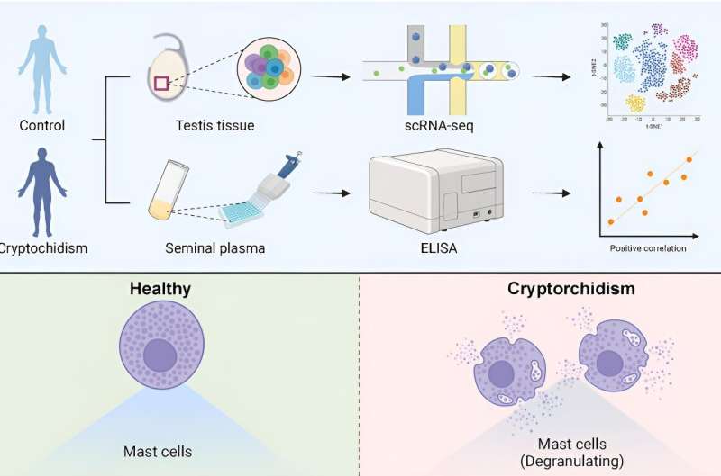 Study deciphers pathological mechanisms of spermatogenic impairment in cryptorchidism