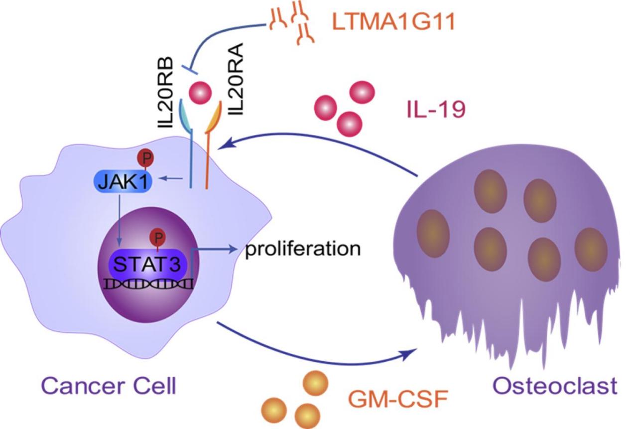 Analyzing a Study on the Therapeutic Potential of Targeting IL-20RB in Lung Cancer Bone Metastasis 