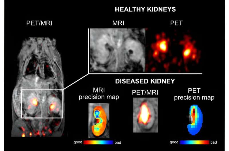 New PET/MRI probe promises early discovery of covert diseases