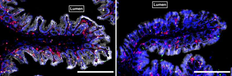 Gut microbiome found to influence location of immune cells