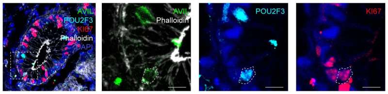 Tuft cells act as regenerative stem cells in the human intestine, study finds