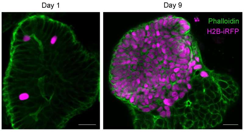 Tuft cells act as regenerative stem cells in the human intestine