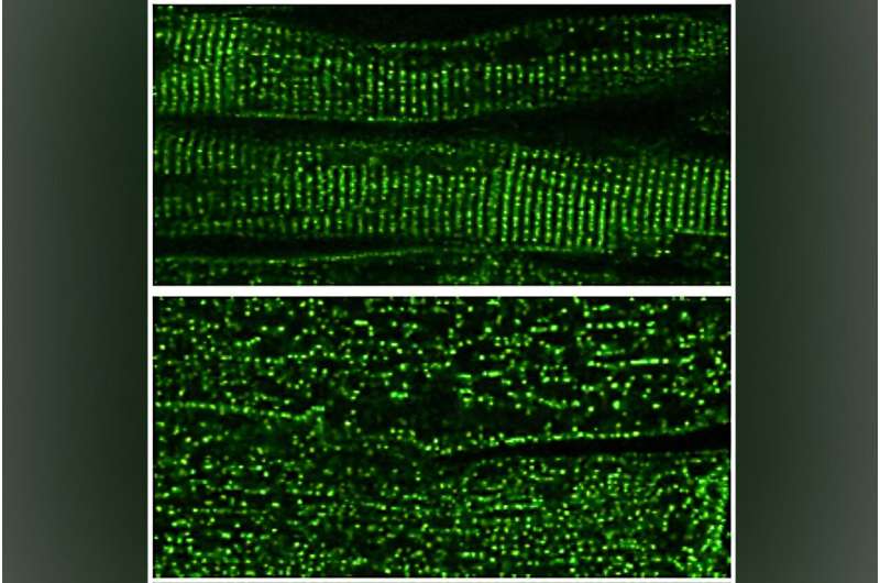 Shoring up the heart muscle's intricately designed structures to treat heart failure