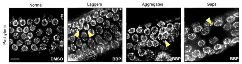 Plastic chemical phthalate causes DNA breakage and chromosome defects in sex cells, new study finds