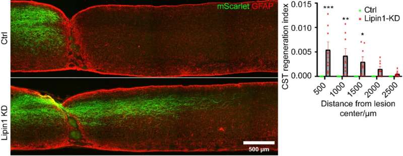 Novel gene discovery paves the way for treating central nervous system injuries