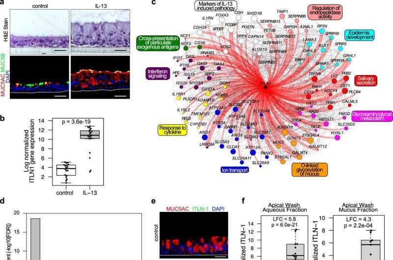 Protein linked to airway obstruction in asthma provides a potential treatment target