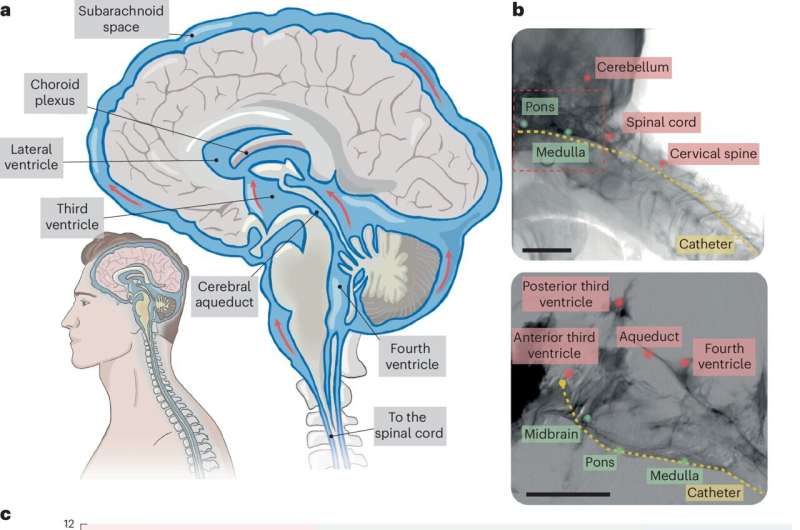 Minimally invasive neural interface allows brain access without skull opening