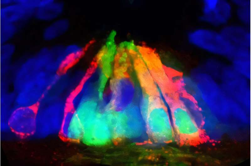 Scientists discover 'entirely unanticipated' role of protein netrin1 in spinal cord development