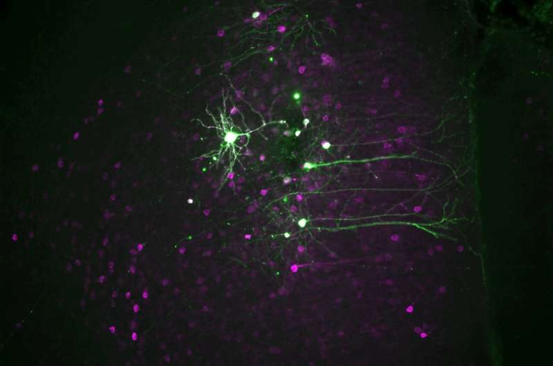 Distinct neural circuits mediate anti-anxiety and hallucination-like effects of psychedelics, research reveals