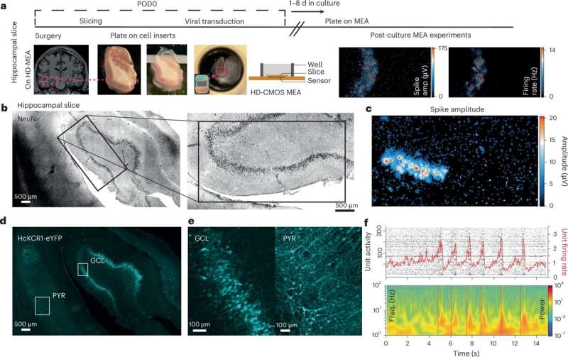 Study shows potential of optogenetics in treating epilepsy