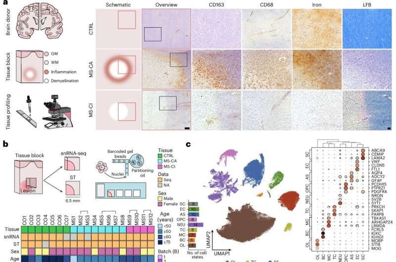 Mapping study provides new insights into cell types and interactions in multiple sclerosis