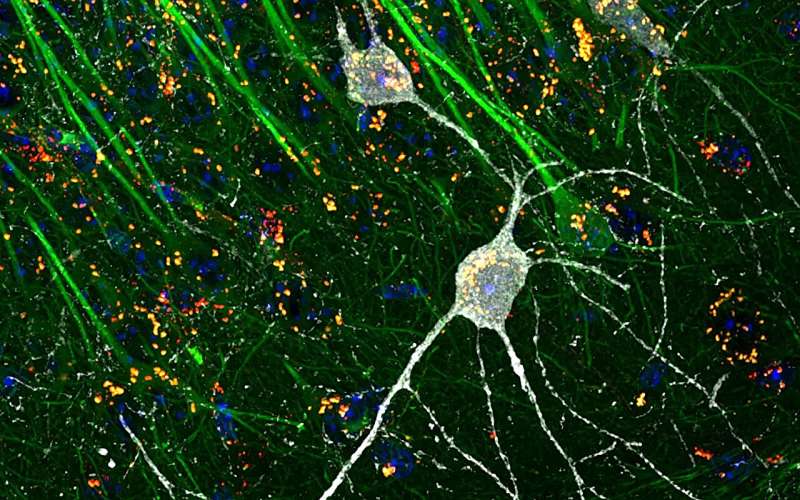 How cells recycle damaged mitochondria in middle age may be critical for brain health