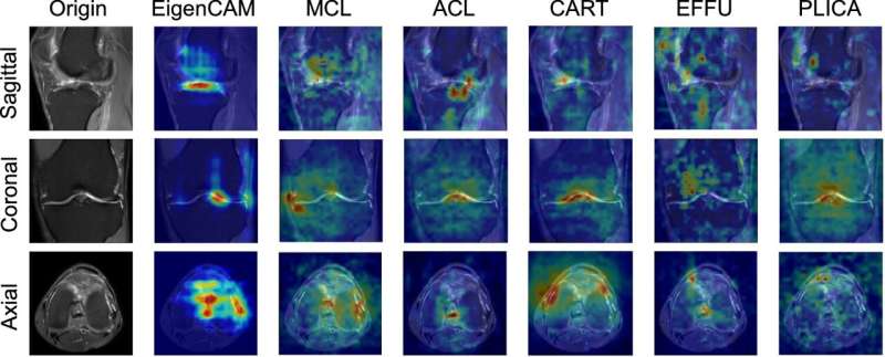 A novel deep learning model for diagnosing knee abnormalities like an experienced radiologist