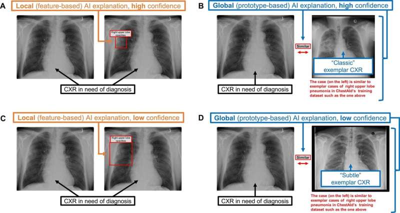 AI advice influences radiologist and physician diagnostic decisions incorrectly, according to new study