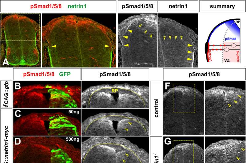 Scientists discover 'entirely unanticipated' role of protein netrin1 in spinal cord development