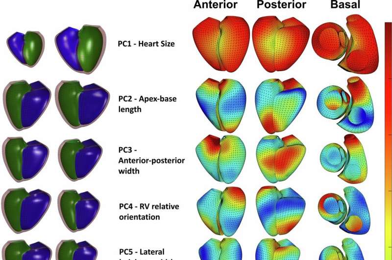 Genetic study links heart shape to cardiovascular disease