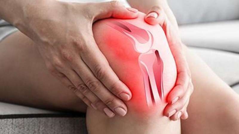 Colchicine no benefit for painful knee osteoarthritis