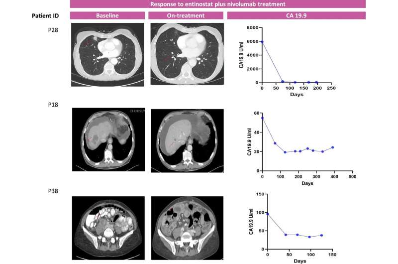 Drug combination prompts immune response in some resistant pancreatic cancers