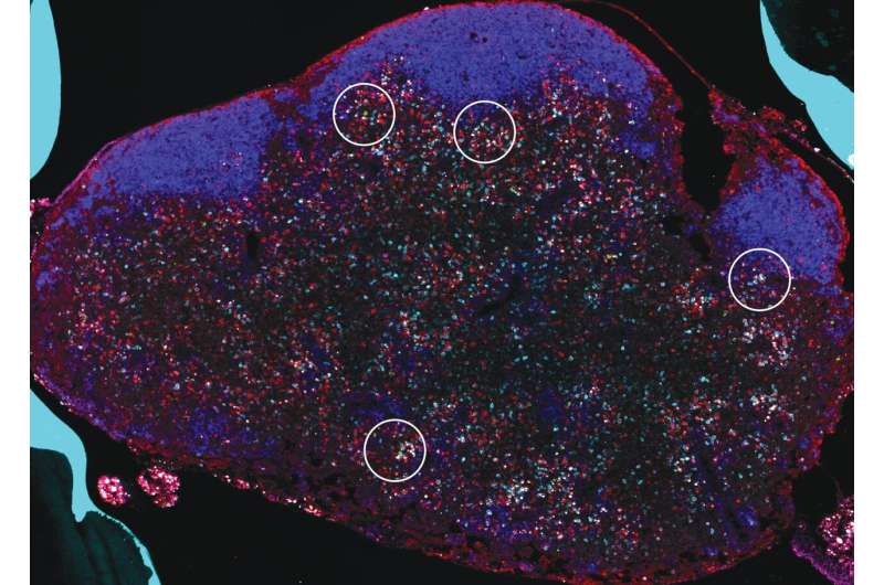 New insights reveal how house dust mites trigger allergic asthma by activating immune system