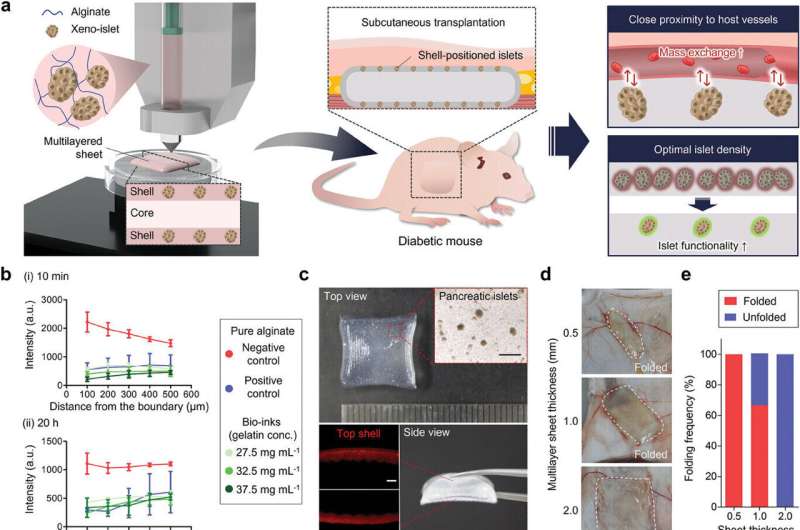 Innovative islet transplant method reduces surgical complications for type 1 diabetes