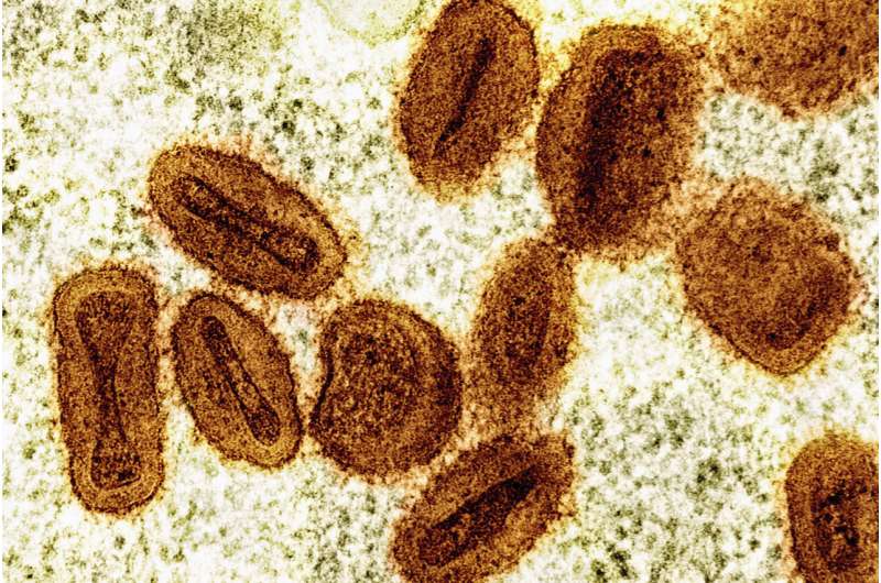 US health officials report 1st case of new form of mpox in a traveler