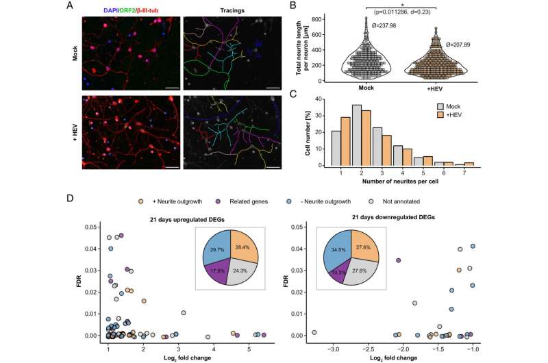 When hepatitis E viruses attack nerve cells