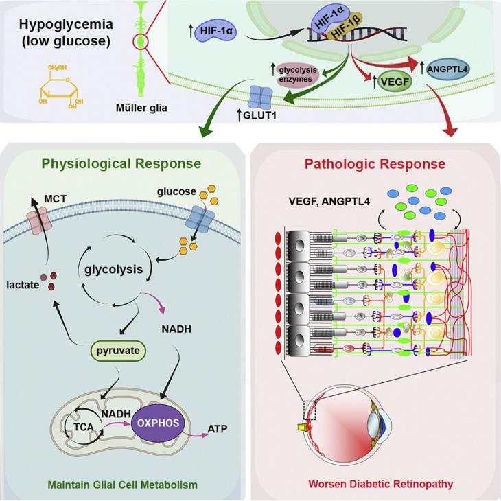 Transient hypoglycemia worsens diabetic retinopathy via HIF-1a activation 