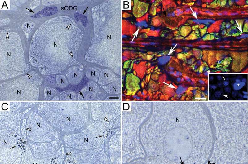 Research on neurodegeneration in spider brain leads team to new discovery in Alzheimer's-affected human brains