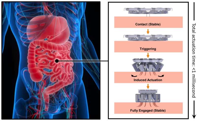 A tapeworm-inspired, tissue-anchoring mechanism for medical devices