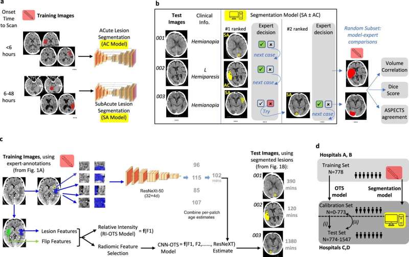 AI stroke brain scan readings found to be twice as accurate as current method