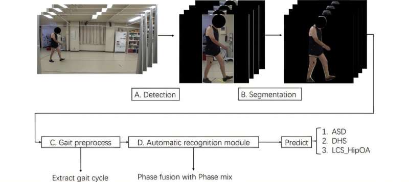 Deep learning enhances gait analysis for spinal deformity detection